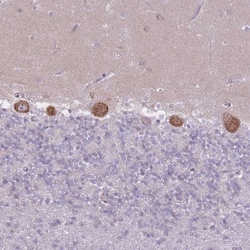 ZNF501 Antibody, Novus Biologicals 0.1mL; Unlabeled:Antibodies, Polyclonal